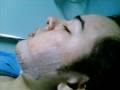 Cirugía Maxilofacial