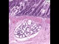 Shotgun Histology Duodenum Shotgun Histology Duodenum