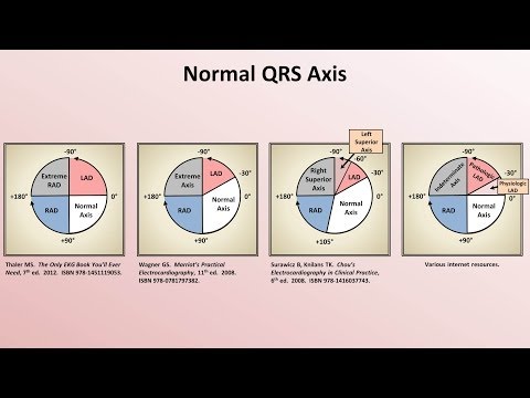 how to measure qrs amplitude