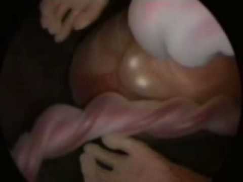 سكس فديو