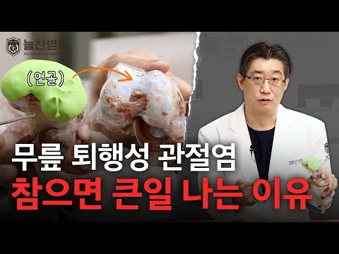 퇴행성 관절염의 단계별로 치료 방법은? | #무릎통증 #무릎수술 ..
