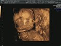 19 week ultrasound! It's a girl! Includes 3d/4d scan!