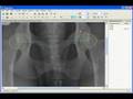 Measurement of Norberg angle in dogs