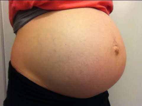 Pregnancy breast