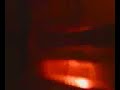 Resonance Peg Resonance Peg