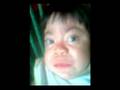 sindrome de hurler
