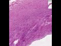 Shotgun Histology Large Artery