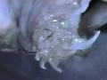 Candiru - Poison Mouth