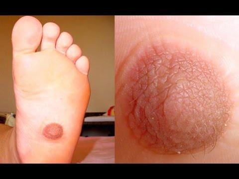 how to know nipple color