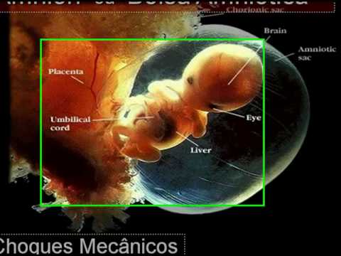 embriologia - Aula de Embriologia - Anexos Embrionários - Parte 1.