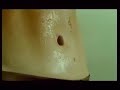 Anorexic people, watch this..cityofbucara.blogspot Anorexic people, watch this..cityofbucara.blogspot