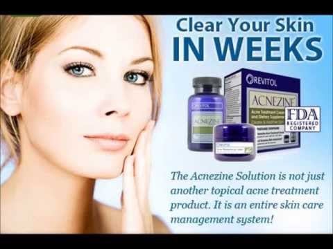 how to treat acne uk