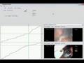 CAS: Monitoring of Surgical Workflow