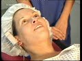 Intravenous Sedation Intravenous Sedation