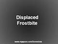 Displaced - Frostbite