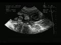K�peklerde Gebelik Ultrasonografisi-1
