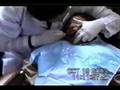 videos de Smile Builders (Constructores de Sonrisas)