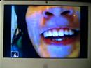 Skype distort