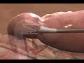scientific visualization medical animation medical device 3d