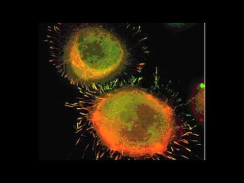 Cancer Facts : How D middot; Breast Cancer Cells cancer cells dividing. Cancer Facts : How D middot; Breast Cancer Cells