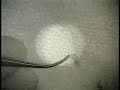 Amniotic Membrane - Eyeplastics.com