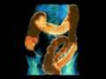 Limpieza Intestinal Profunda FLP