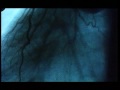 THRESHOLD - Halbg�tter in Wei� Trailer