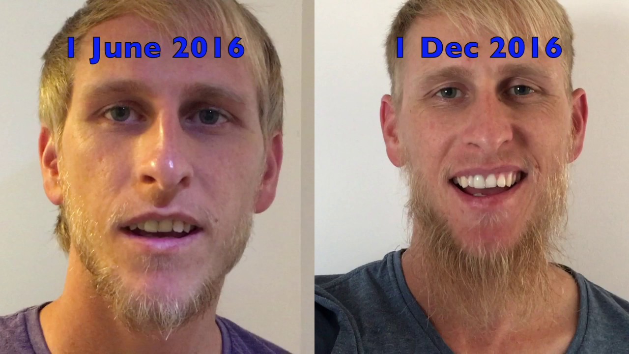 Can a blonde guy grow a beard?