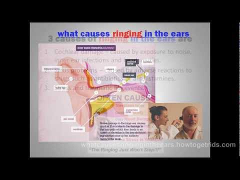 what causes ringing in the ears – The Shocking Truth About Tinnitus Miracle