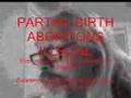 Abortion Rights Dismantled