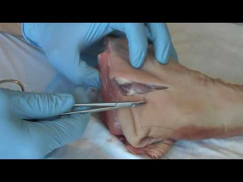 technique - Demonstration of basic good suture technique and habits. This is an instructional video to teach emergency medical care of basic suture technique when perfor...