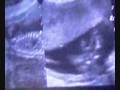 videos de ECO 4 MESES frijotilo