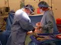 New chemo treatment helps remove abdominal cancers New chemo treatment helps remove abdominal cancers
