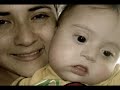 Down syndrome:&nbsp;S�ndrome de Down: Para�so Down 1