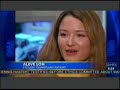 ABC Good Morning America - Eyelash Transplants ABC Good Morning America - Eyelash Transplants