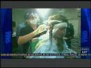 ABC Good Morning America - Eyelash Transplants