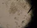 Micro-organisms Under The  Microscope