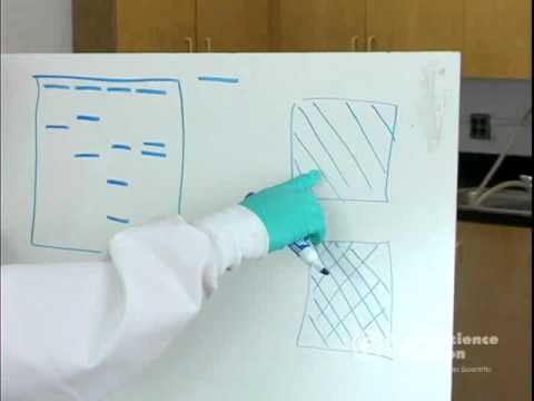 how to read gel electrophoresis