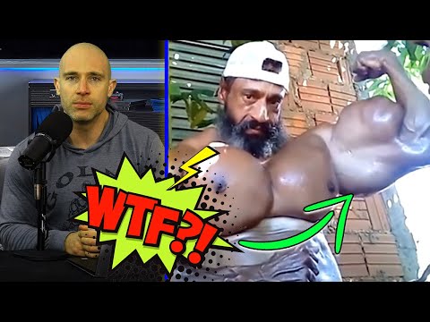 'Top 10 People With Fake Muscles That Look Ridiculous' REACTION!!