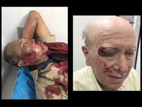 José Manuel Olivares: La GNB utiliza metras para asesinar a los venezolanos durante protestas