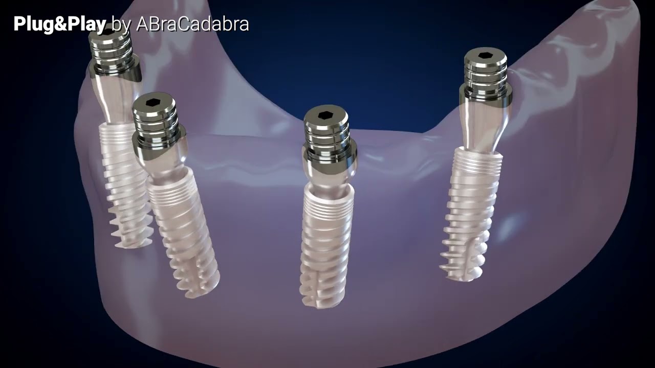 ABraCadabra Plug & Play Restorative Concept