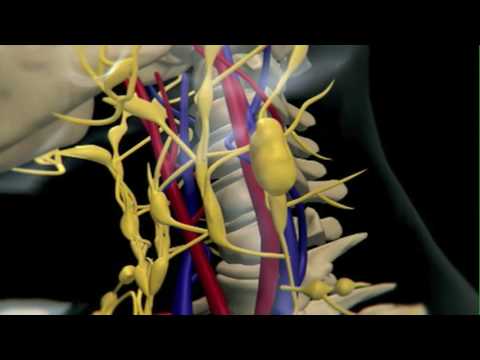 An Animation Explaining the Development of Lymphoma