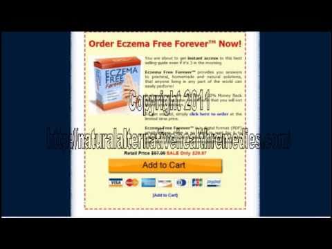 how to heal eczema fast