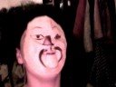 Thoughts On Cosmetic Surgery?