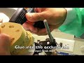 Glue gun mounting dental casts Glue gun mounting dental casts