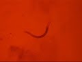 c elegans NpHR yellow light c elegans NpHR yellow light