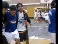 TATO lesion a la UñA