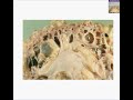 Histopathology Kidney--Adult polycystic disease Histopathology Kidney--Adult polycystic disease