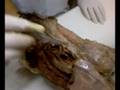 anato-videos11