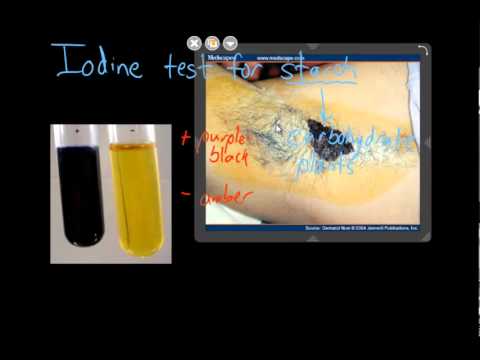 how to perform iodine test for starch